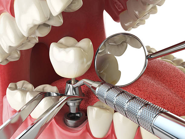 Best 24-Hour Emergency Dentist in Mattoon, IL