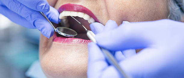 Best Emergency Gum Treatment in Mattoon, IL